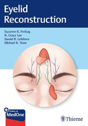 Eyelid Reconstruction by Freitag, Suzanne K