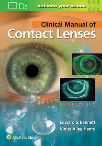 Clinical Manual of Contact Lenses 5e by Bennett, Edward S.