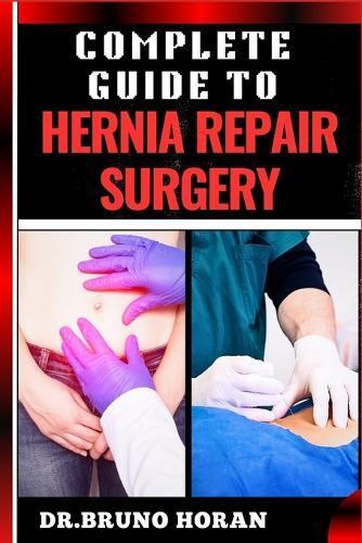 DR. BRUNO HORAN Bruno Horan Complete Guide to Hernia Repair Surgery (Tascabile)