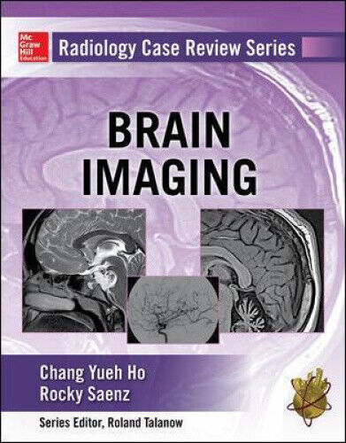 Radiology Case Review Series: Brain Imaging by Chang Ho