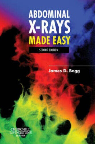 Abdominal X-Rays Made Easy (Made Easy)