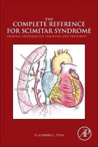 The Complete Reference for Scimitar Syndrome: Anatomy, Epidemiology, Diagnosis