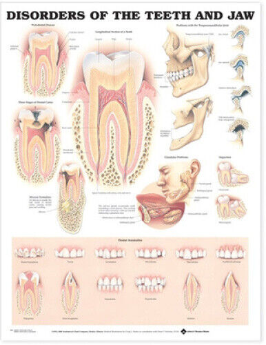Disorders of the Teeth and Jaw Anatomical Chart by Anatomical Chart Company