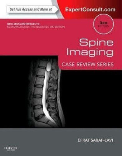 Spine Imaging: Case Review Series: Expert Consult - Online and Print (Case
