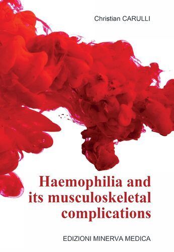 Haemophilia and its musculoskeletal complications