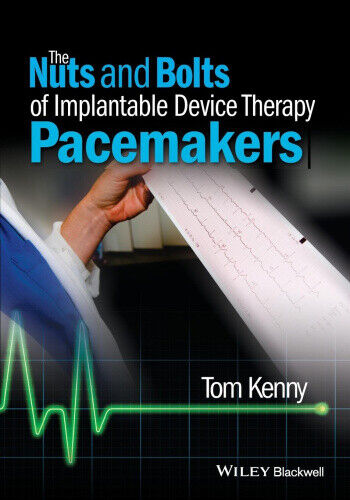 The Nuts and Bolts of Implantable Device Therapy: Pacemakers (The Nuts and