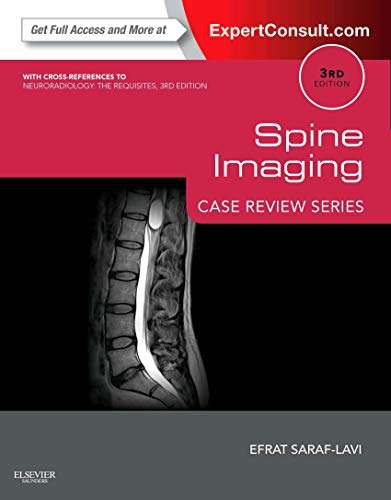 Spine Imaging: Expert Consult - Online And Print