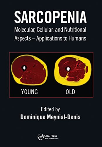 Sarcopenia: Molecular, Cellular, And Nutritional Aspects – Applications To Humans