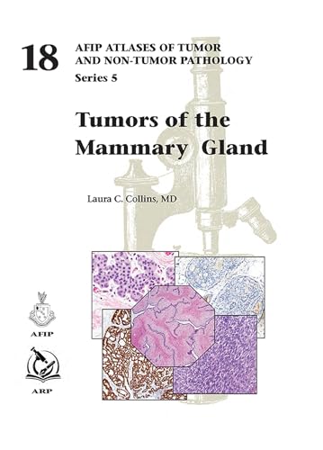 Tumors Of The Mammary Gland