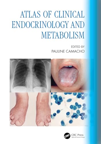 Atlas Of Clinical Endocrinology And Metabolism