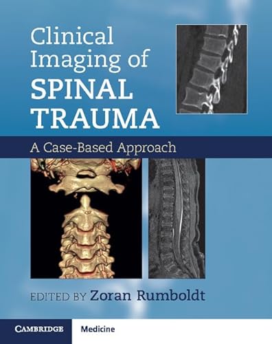 Clinical Imaging Of Spinal Trauma: A Case-Based Approach