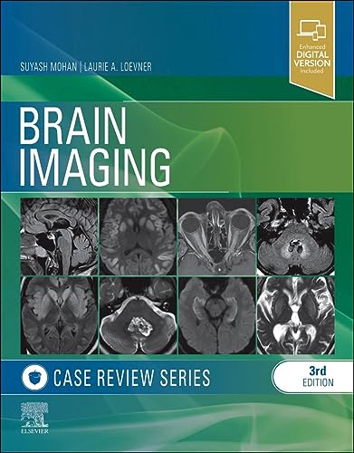 Brain Imaging