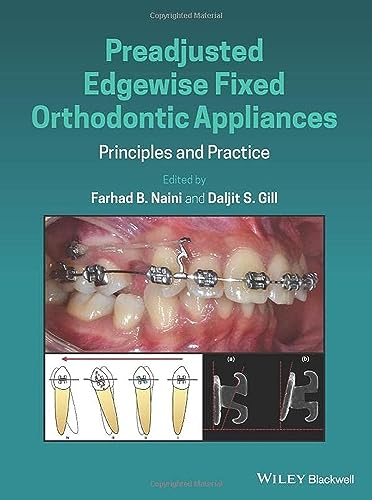 Preadjusted Edgewise Fixed Orthodontic Appliances: Principles And Practice