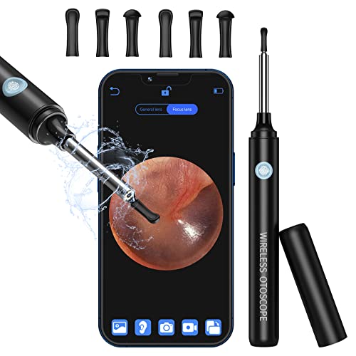 Lmechn Otoscopio 1080P, Pulitore Orecchie Wifi Con Controllo App, Rimozione Cerume Con 6 Led, Kit Pulizia Orecchie Impermeabile Ip67 Per Ios, Android,