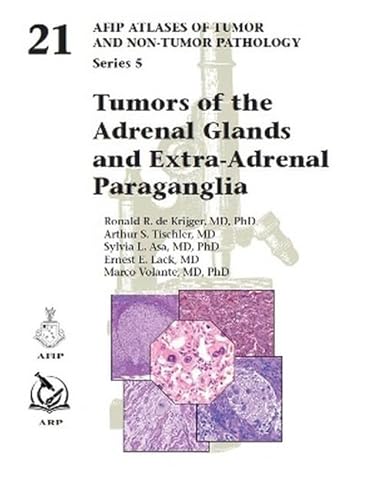 Tumors Of The Adrenal Glands And Extra-Adrenal Paraganglia: 21