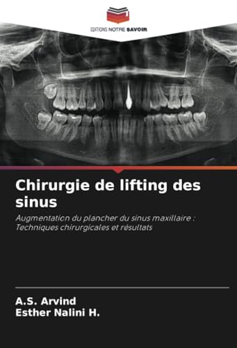 Chirurgie De Lifting Des Sinus: Augmentation Du Plancher Du Sinus Maxillaire : Techniques Chirurgicales Et Résultats