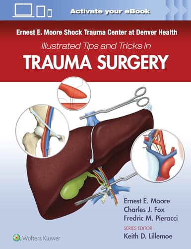 Ernest E. Moore Shock Trauma Center At Denver Health Illustrated Tips And Tricks In Trauma Surgery