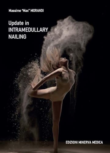 Update In Intramedullary Nailing