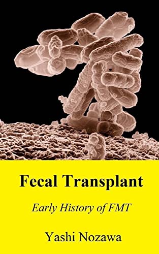 Fecal Transplant: Early History Of Fmt