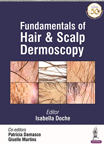 Fundamentals Of Hair And Scalp Dermoscopy