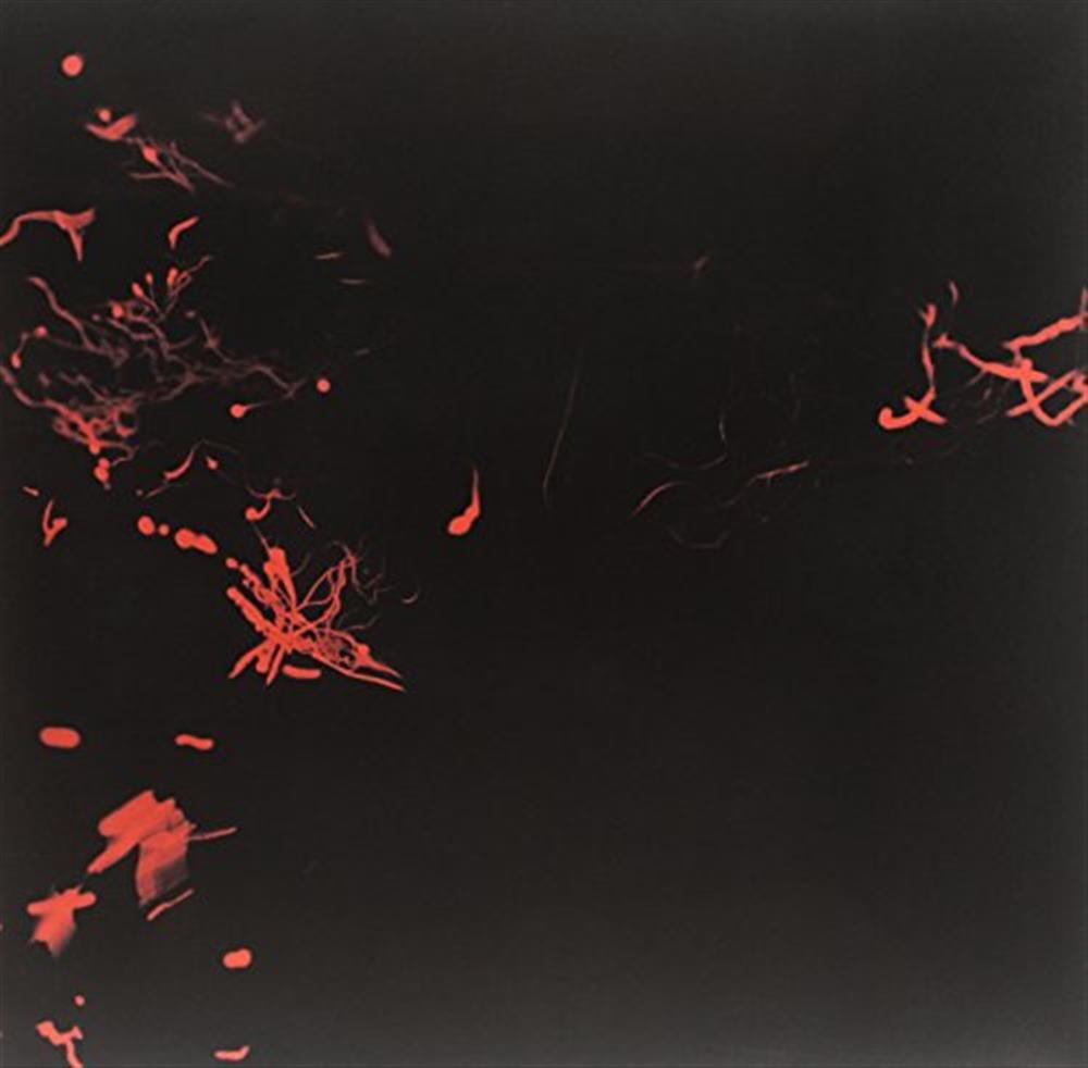 Moss Garden - Svarte Greiner (Vinile)