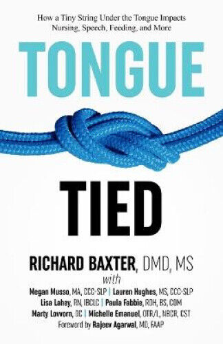 Tongue-Tied: How a Tiny String Under the Tongue Impacts Nursing, Speech,