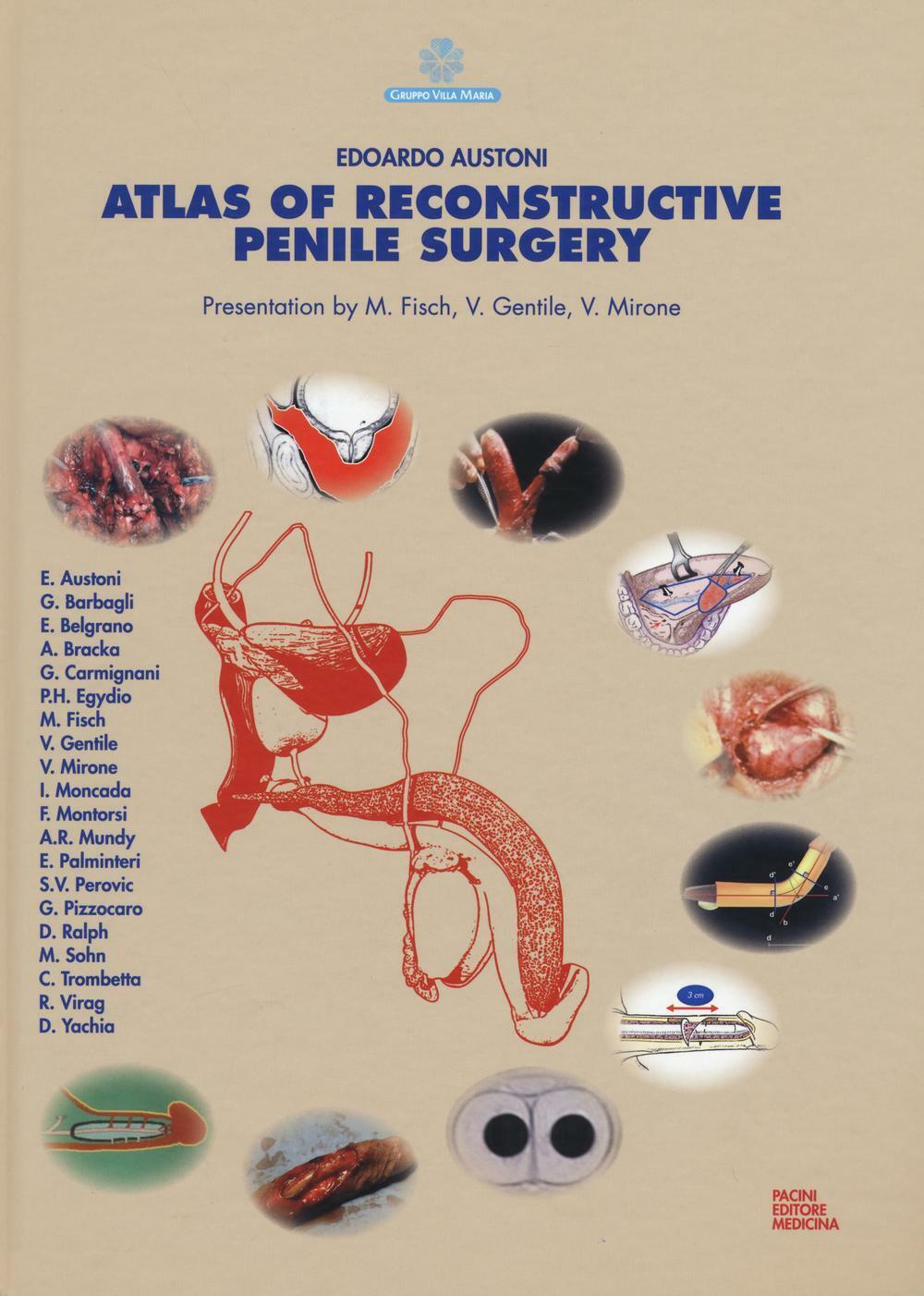 Atlas of reconstructive penile surgery - Austoni E. (cur.)