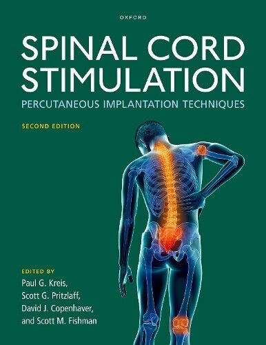 Spinal Cord Stimulation (Copertina rigida)