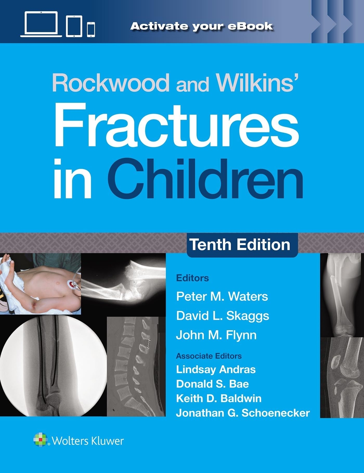 LIbri UK/US Skaggs - Rockwood And Wilkins Fractures In Children: Print Ebook Wit