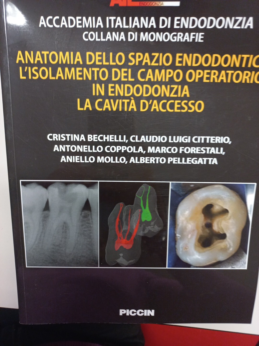 Anatomia Dello Spazio Endodontico