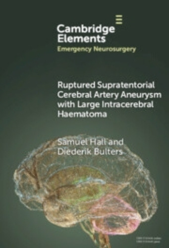 Ruptured Supratentorial Cerebral Artery Aneurysm with Large Intracerebral