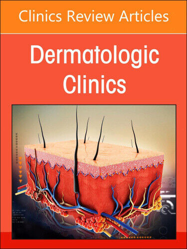 Psoriasis: Contemporary and Future Therapies, An Issue of Dermatologic