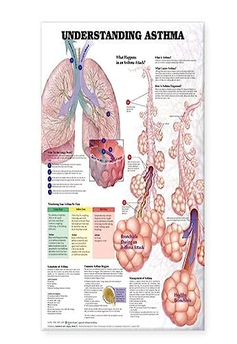 Understanding Asthma Anatomical Chart