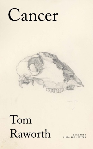 Tom Raworth Cancer (Tascabile)