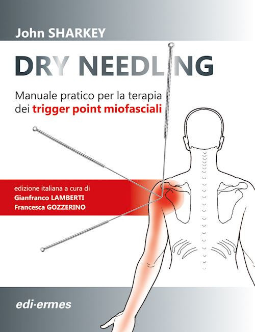 DRY NEEDLING - TRIGGER POINT MIOFASCIALI.  - SHARKEY JOHN, LAMBERTI G.
