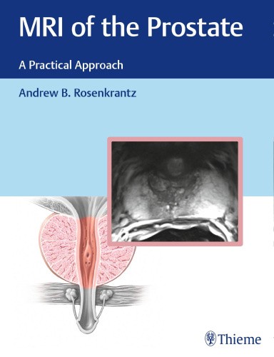 MRI of the Prostate: A Practical Approach by Andrew Rosenkrantz