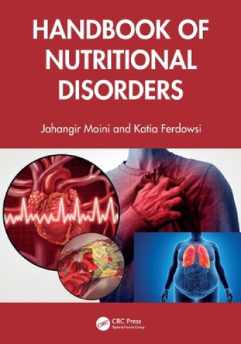 Handbook of Nutritional Disorders by Moini, Jahangir