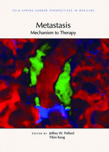 Metastasis: Mechanism to Therapy (Perspectives Cshl) by Jeffrey W Pollard