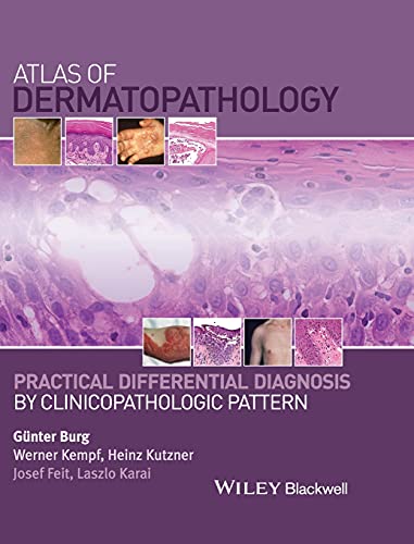 Atlas Of Dermatopathology: Practical Differential Diagnosis By Clinicopathologic Pattern