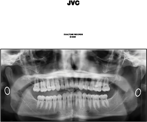 Jvc