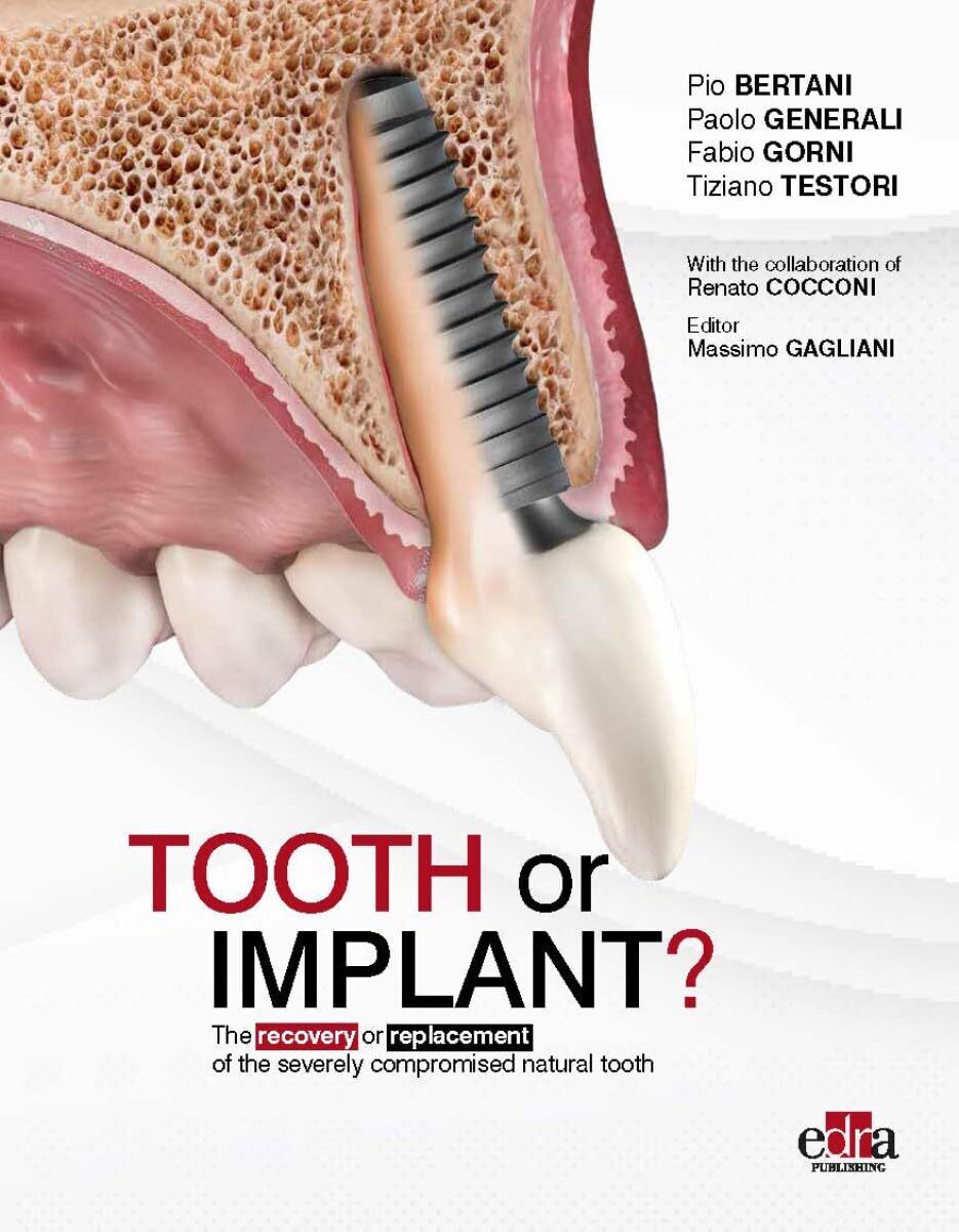 9781957260525 Tooth or Implant? The recovery or replacement of t...natural tooth