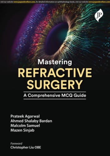 Mastering Refractive Surgery: A Comprehensive MCQ Guide by Prateek Agarwal