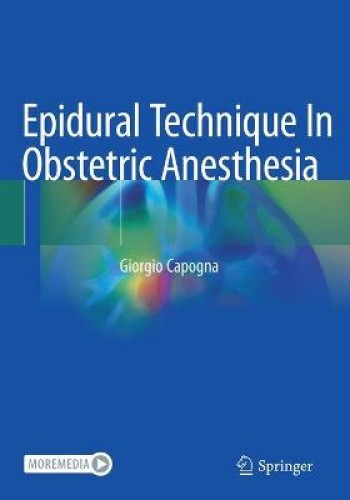 Epidural Technique In Obstetric Anaesthesia by Capogna, Giorgio