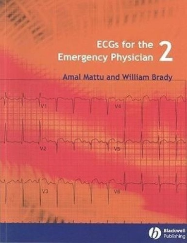 ECGs for the Emergency Physician: Level 2 by Amal Mattu [Paperback]