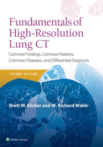 Fundamentals of High-Resolution Lung CT: Common Findings, Common Patterns,