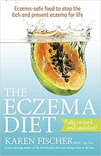 Karen Fischer The Eczema Diet (Tascabile)