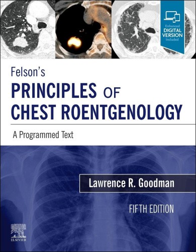 Felson's Principles of Chest Roentgenology, a Programmed Text: A Programmed Text