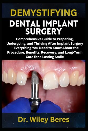 Demystifying Dental Implant Surgery: Comprehensive Guide To Preparing, Undergoing, And Thriving After Implant Surgery – Everything You Need To Know ..