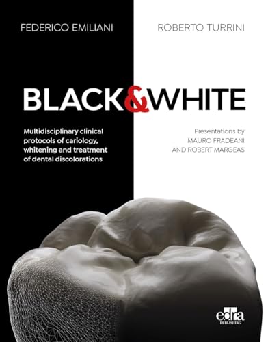 Black&White. Multidisciplinary Clinical Protocols Of Cariology, Whitening And Treatment Of Dental Discolorations. Con Qr Code