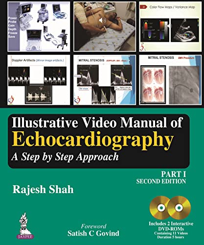 Illustrative Video Manual Of Echocardiography: A Step By Step Approach: A Step By Step Approach - Part 1